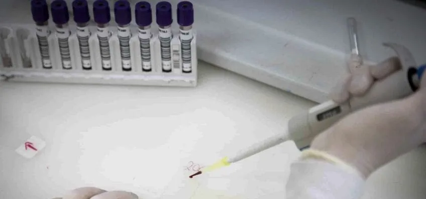 Paciente com suspeita de ebola em SP está com meningite