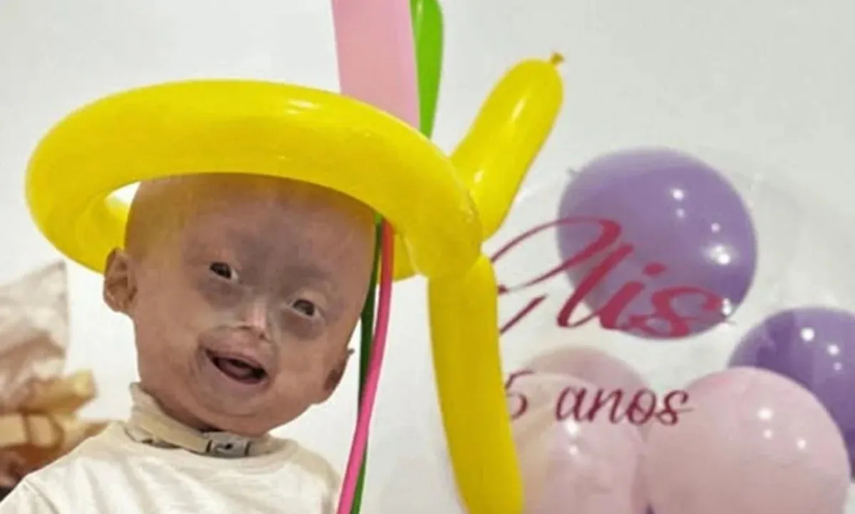Mãe de menina que morreu aos 5 anos com síndrome do envelhecimento precoce faz homenagem: ‘Era encantadora’
