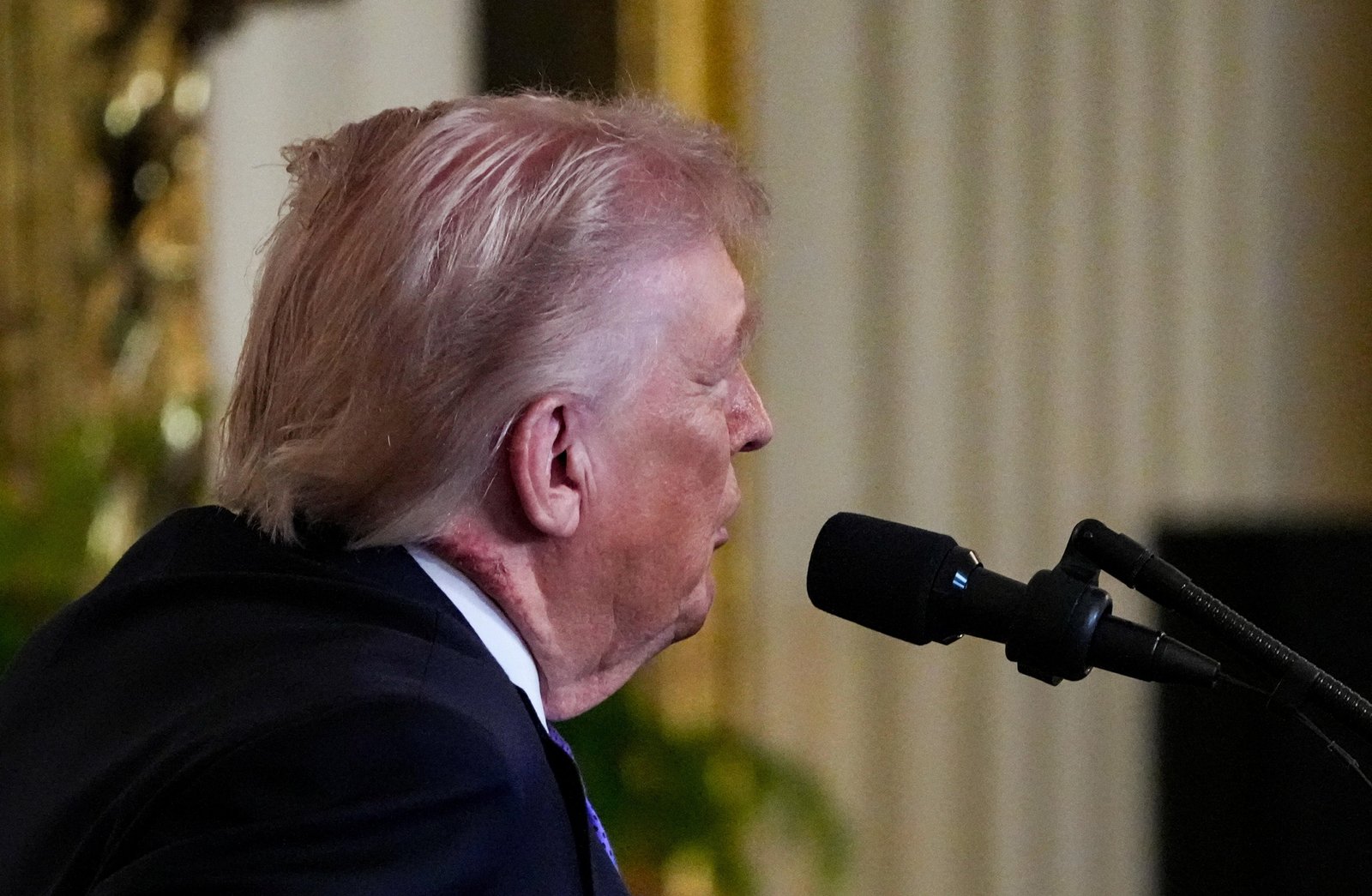 Trump aparece em público com hematoma no pescoço | G1