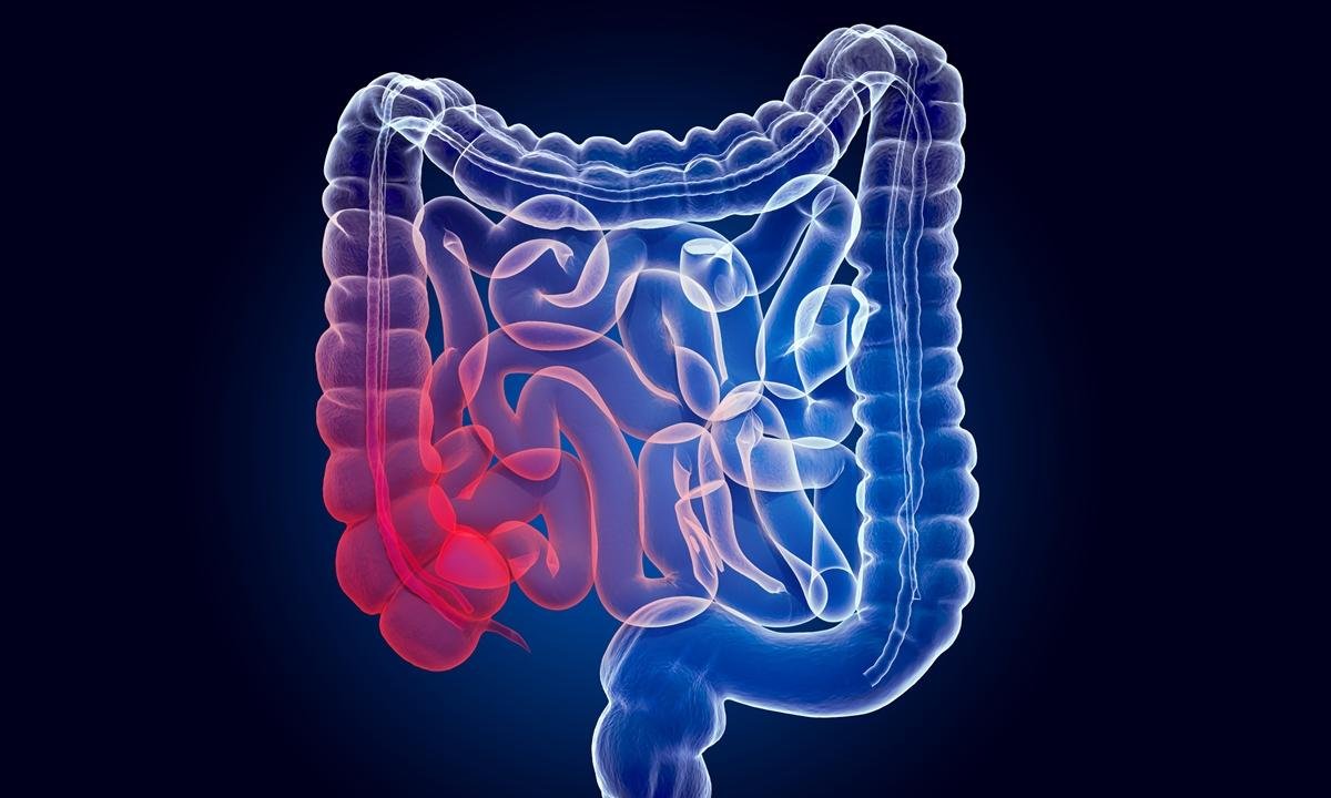 Coloproctologista aponta os principais sintomas de câncer de intestino