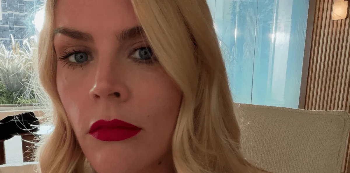 Busy Philipps, de ‘As Branquelas’, revela tumor raro no cérebro