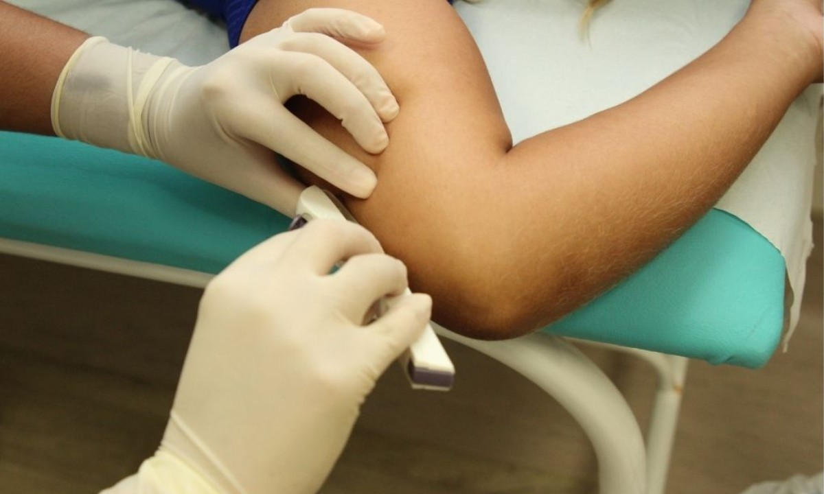 'Chip anticoncepcional' será oferecido gratuitamente em Teresina | G1