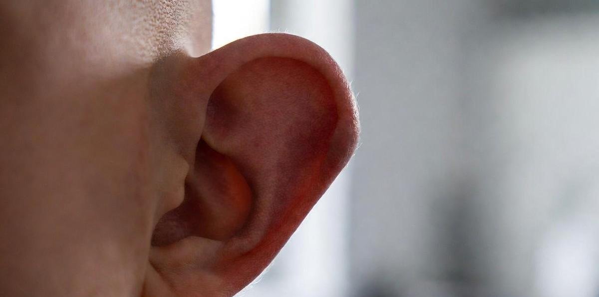 Orelha em abano: um problema social grave, por Dr. Milton Seigi Hayashi