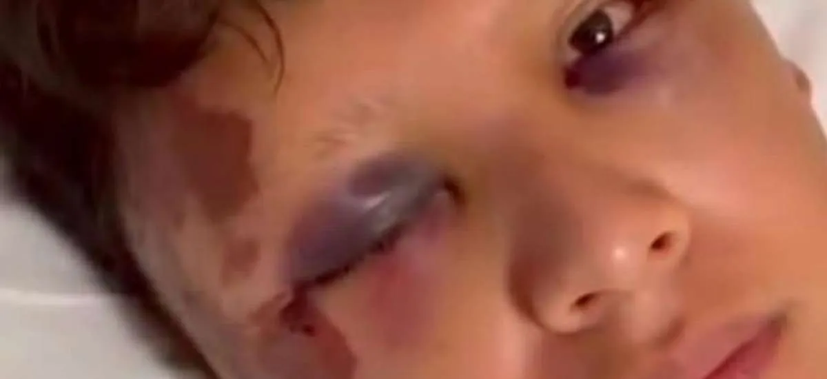 Turista mexicano é agredido com garrafada na cabeça em Copacabana
