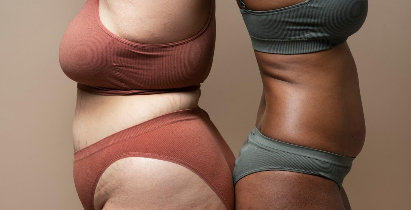 Furinhos na pele: entenda a diferença entre celulite, estética e saúde