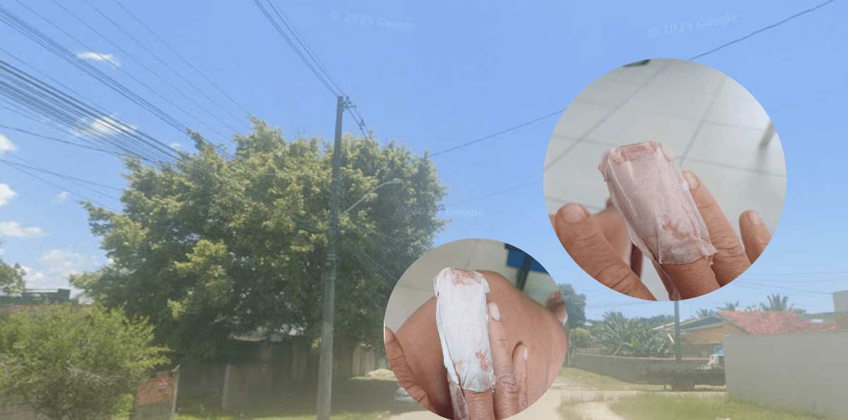 Pitbull foge de casa, ataca casal e mata cachorro em Caraguatatuba