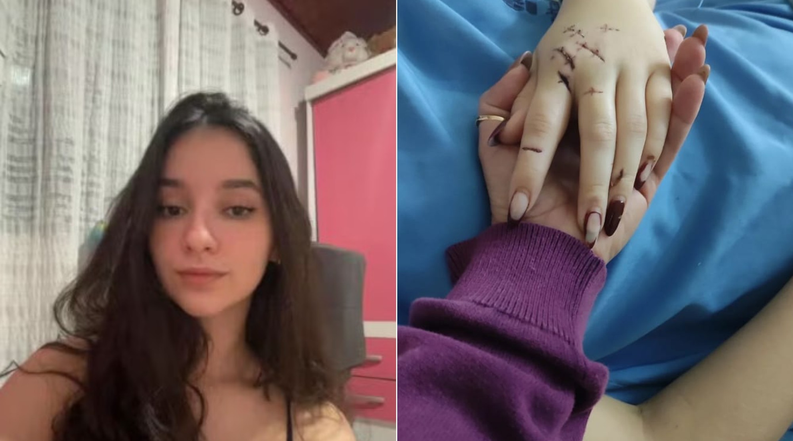 Mãe diz que jovem ferida a facadas em São Gonçalo contou detalhes de ataque: 'Ela lembra de tudo'