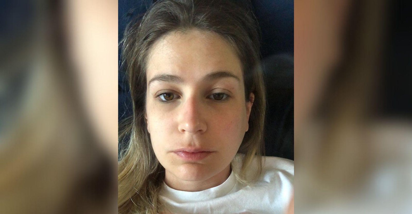 Publicitária descobre Síndrome de Sjögren dez anos após ter sintomas | G1