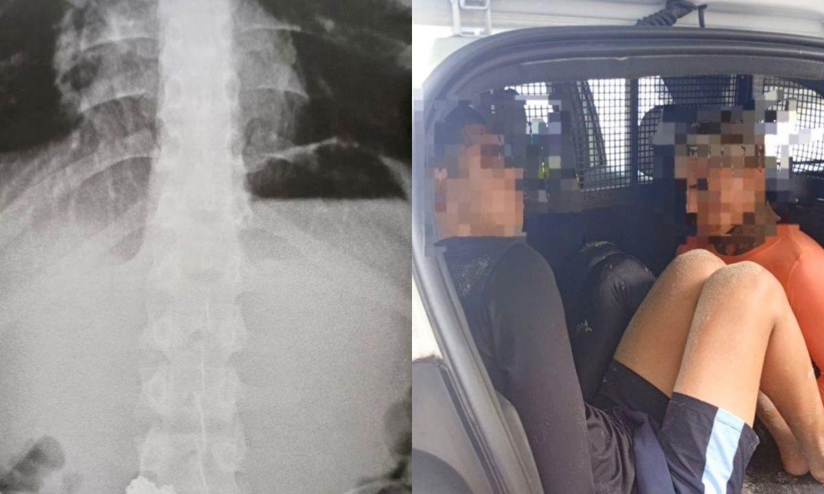 Ladrão engole correntinhas de ouro em tentativa de fuga em Guarujá, SP | G1