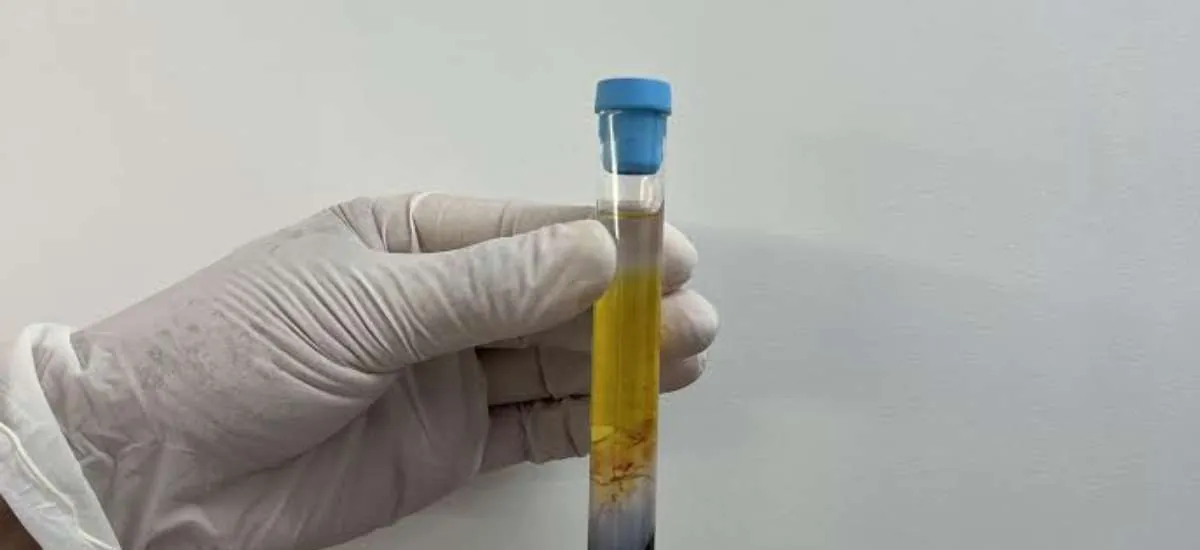 CFM regulamenta PRP em condições osteomusculares