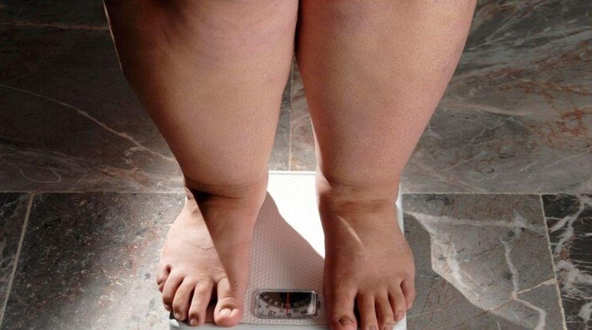 RN é o 2º estado do país com mais adultos obesos | G1