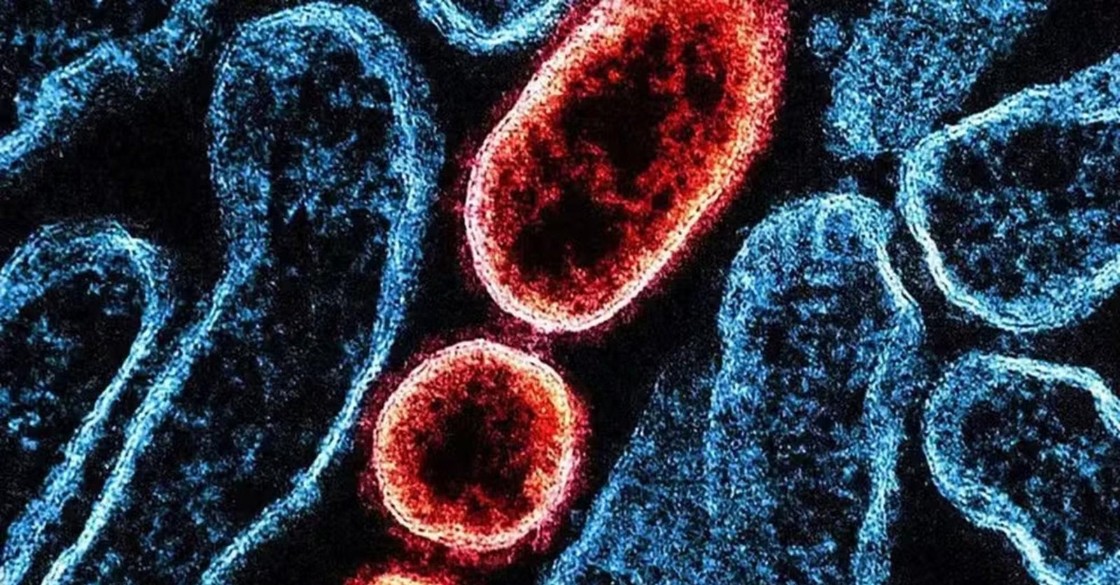 É falso que OMS alertou para risco global do vírus Nipah após Carnaval | G1
