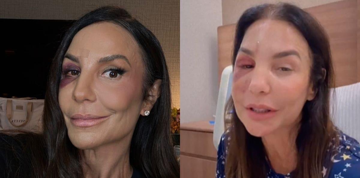 Ivete Sangalo vai cantar no BBB26? Cirurgia da cantora pode ser entrave