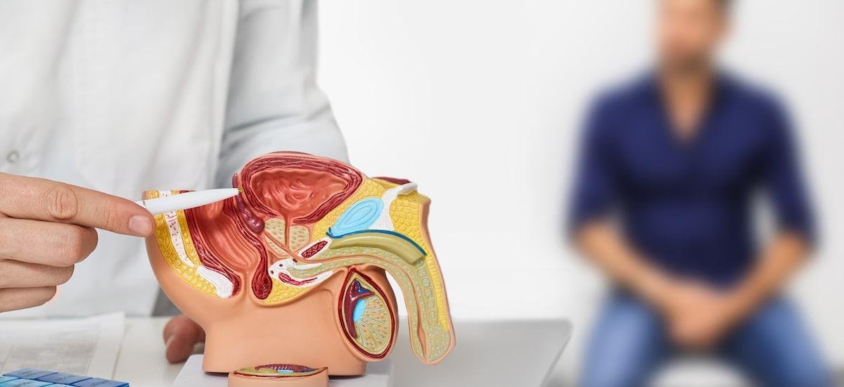 Opinião | Combate ao câncer de próstata começa pela quebra de tabus — e esse é só um dos desafios