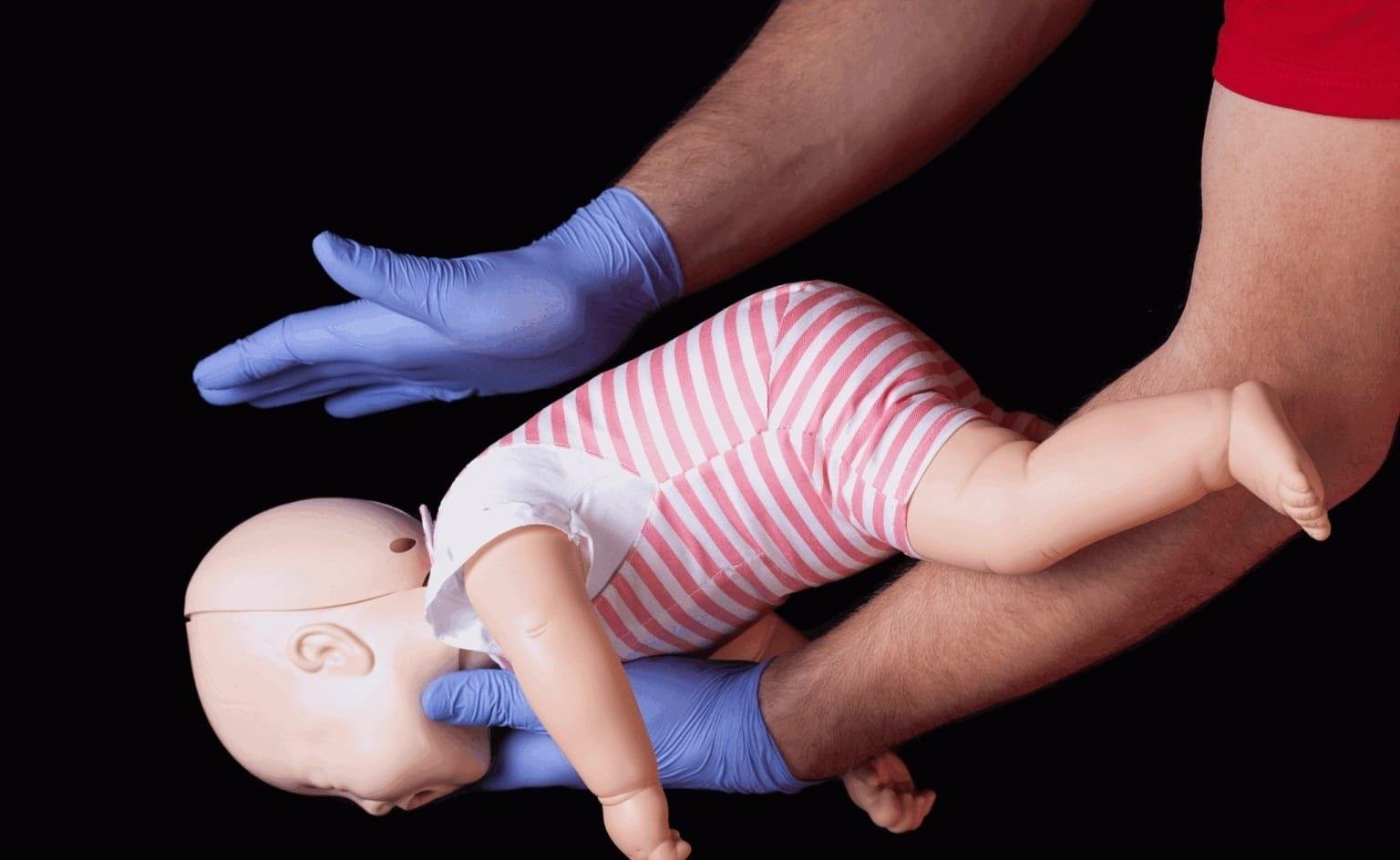 Manobras para desengasgar crianças: manobra de helmich e tapotagem