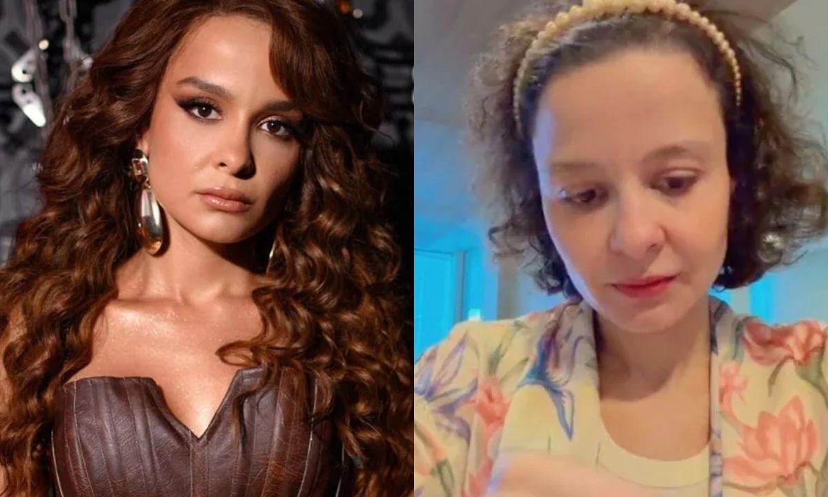 Alopecia androgenética: caso da cantora Maiara levanta alerta