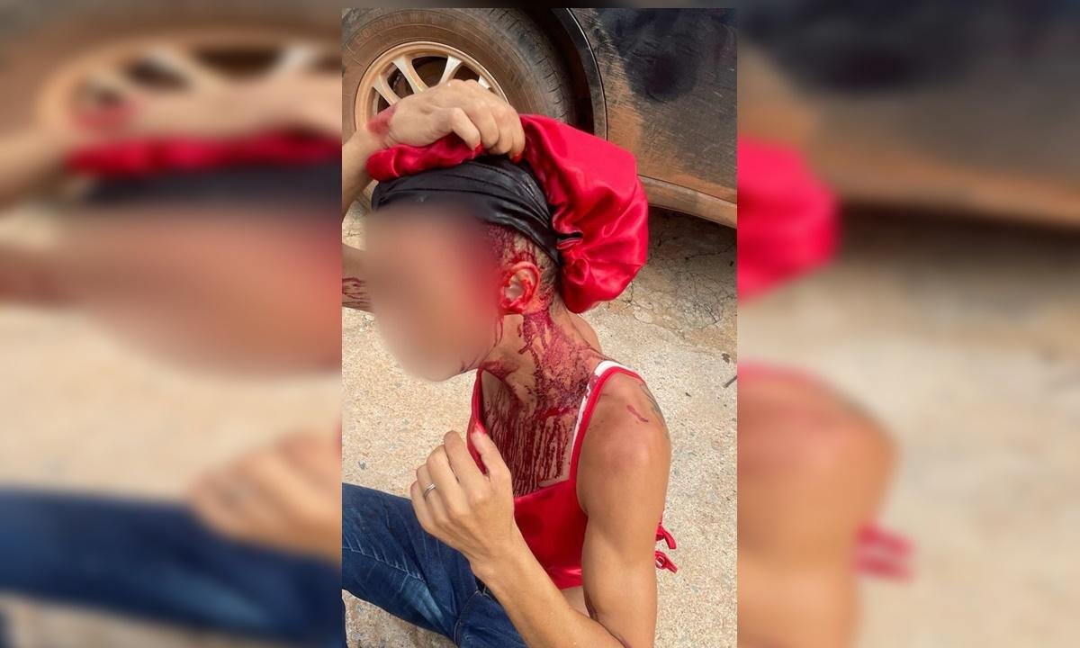 Mulher trans é brutalmente agredida com barra de ferro por homem no DF