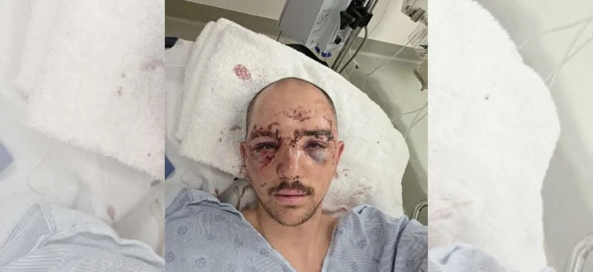 Homem vai caçar e acaba atacado por urso-pardo: 'Ouvi meus ossos quebrarem'