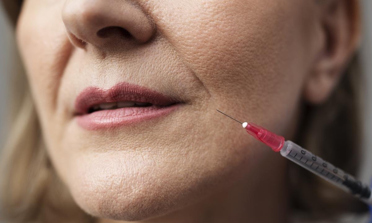 Anvisa proíbe venda de bioestimulador de colágeno Sculptra falsificado