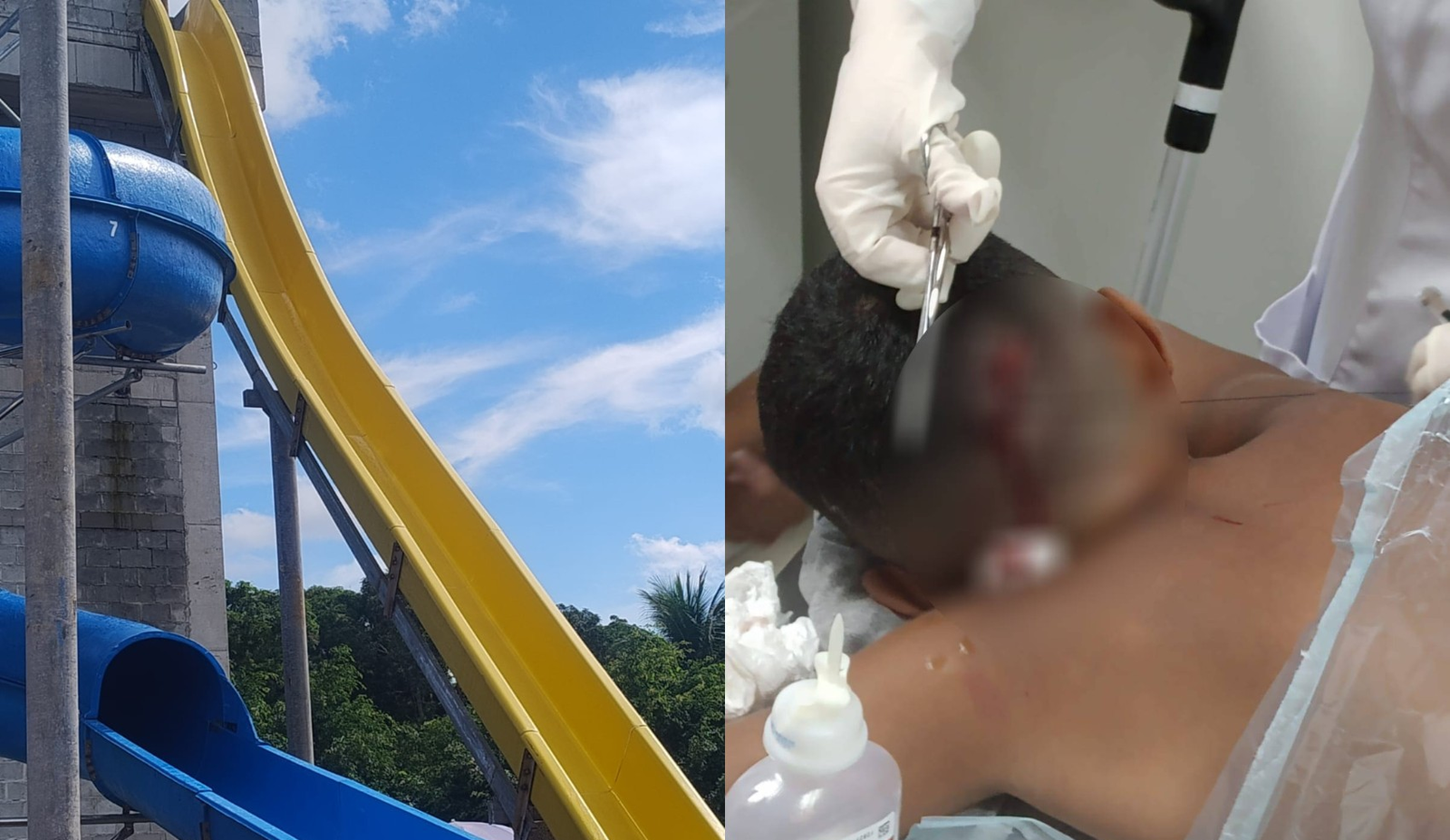 Criança sofre ferimento na cabeça em tobogã de parque em Abreu e Lima | G1