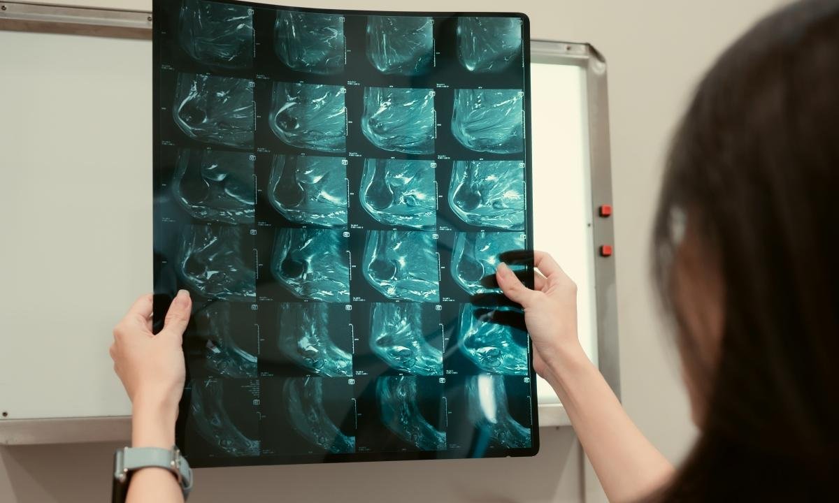 Oncologista conta 5 crenças sobre o câncer que atrapalham o tratamento