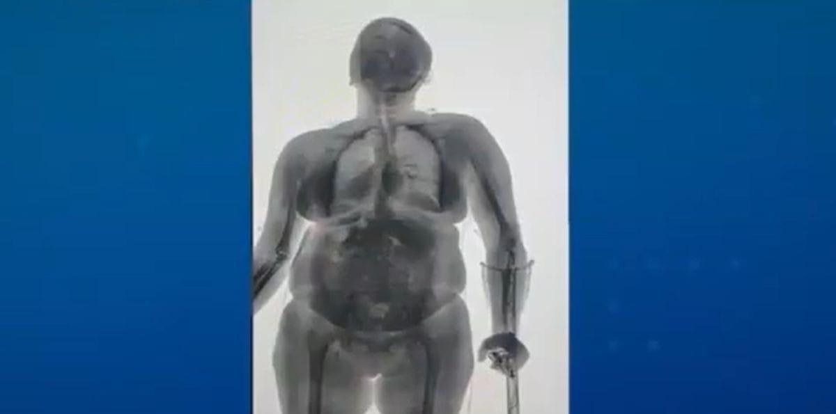 Mulher é flagrada com drogas escondidas em muleta e chinelo em cadeia