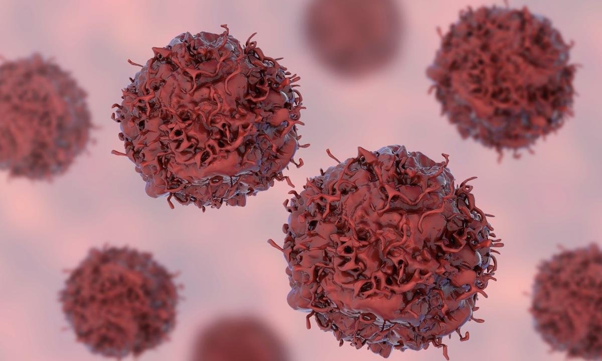 40% dos casos de câncer poderiam ser evitados, afirma relatório da OMS