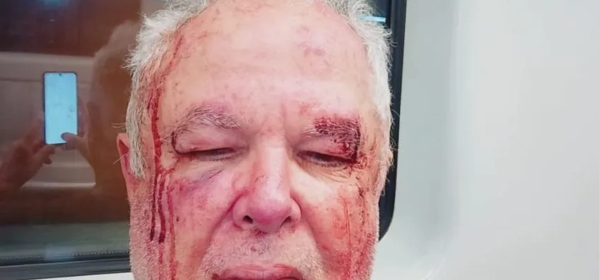 Polícia investiga agressão a militante do PT em Copacabana