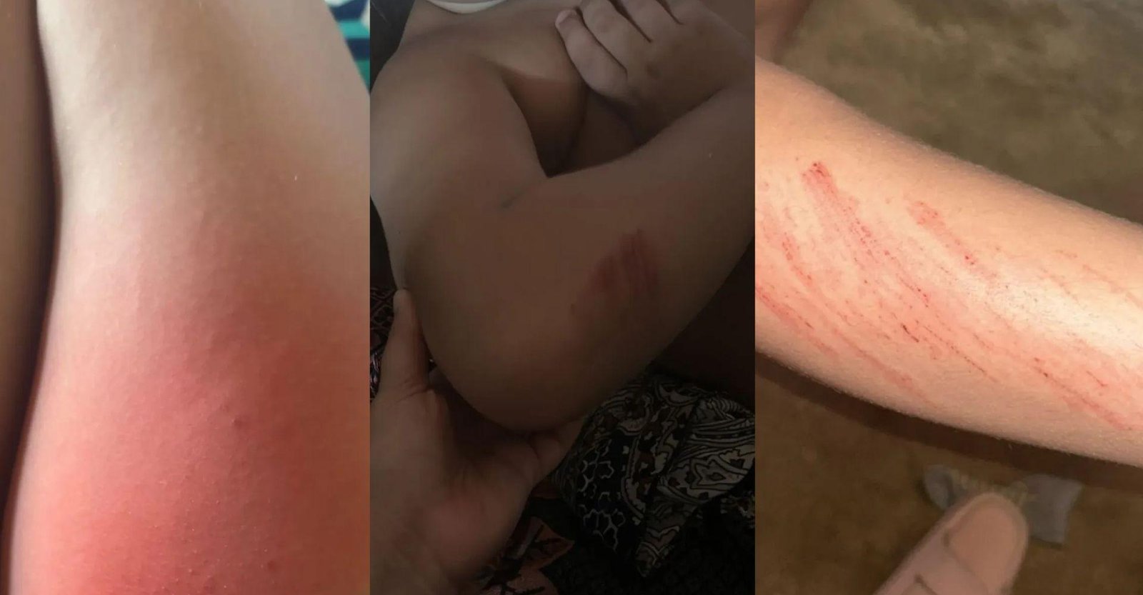 Família denuncia agressão a criança autista em escola de Campina Grande | G1