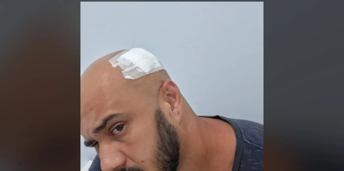 Motorista de app diz ter sido agredido por cliente com chave de roda | G1
