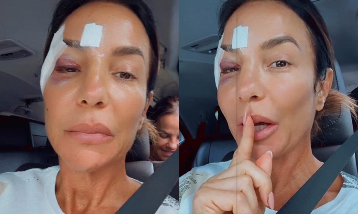 Ivete Sangalo atualiza estado de saúde após desmaio e internação