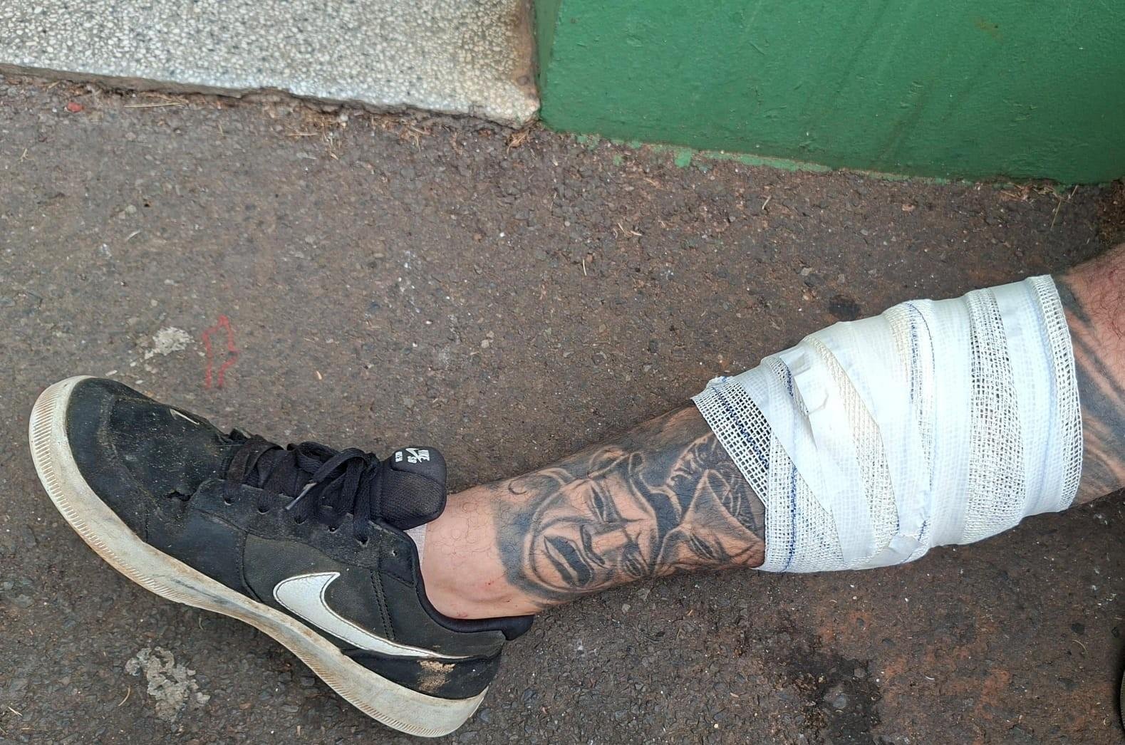 Secretaria de Meio Ambiente reforça necessidade de descarte adequado de lixo | G1