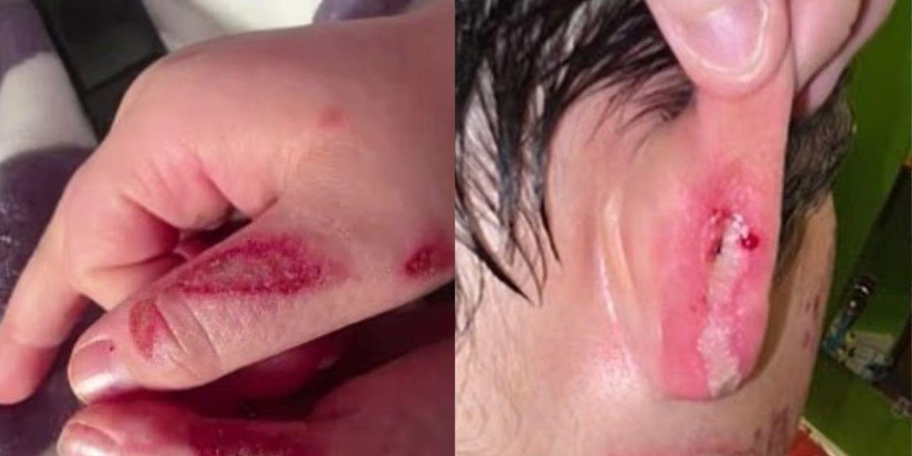 'Trend': Menino de 9 anos sofre queimaduras após seguir desafio do TikTok com micro-ondas nos EUA