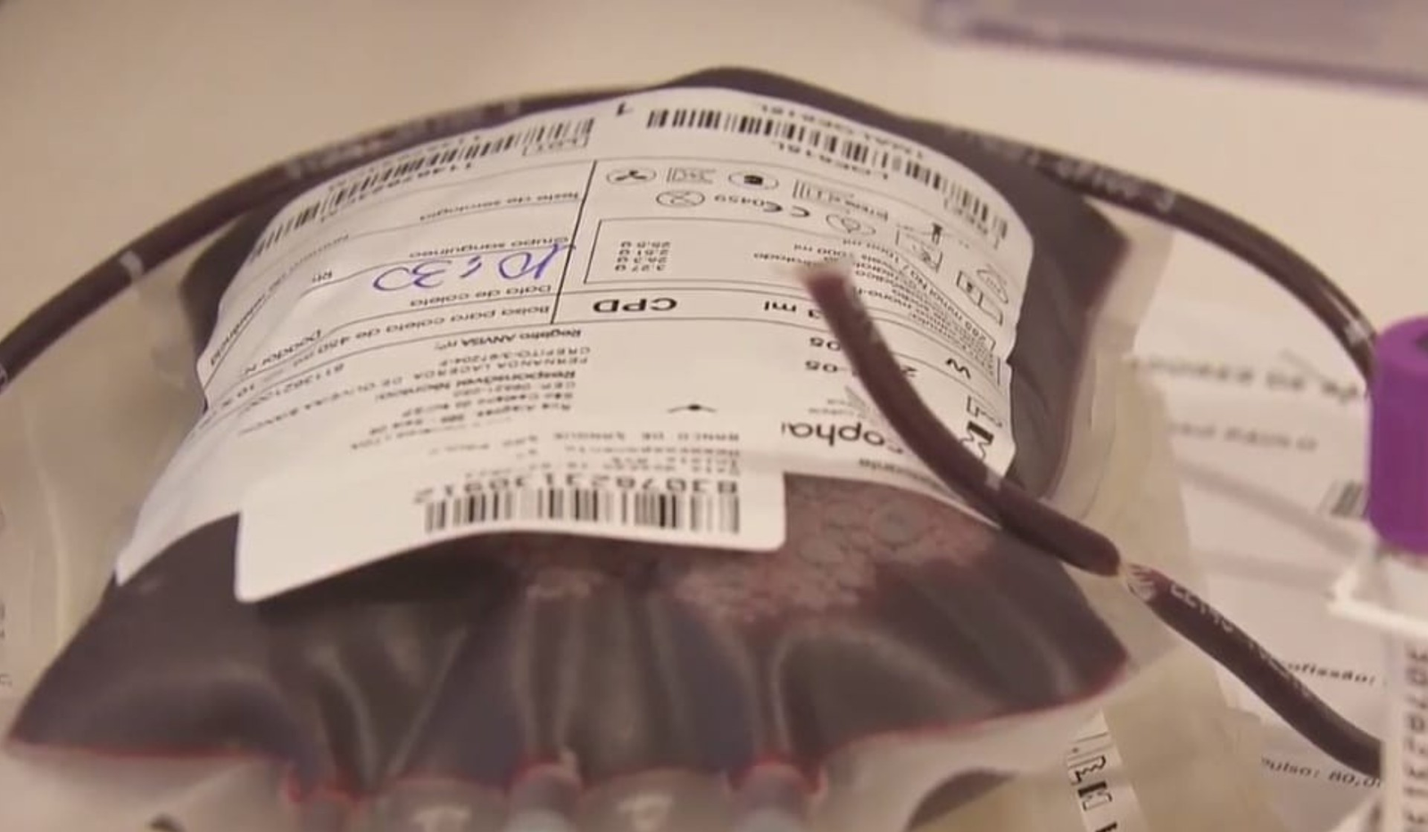 Estoque de sangue está em estado crítico em Catanduva; veja como doar | G1