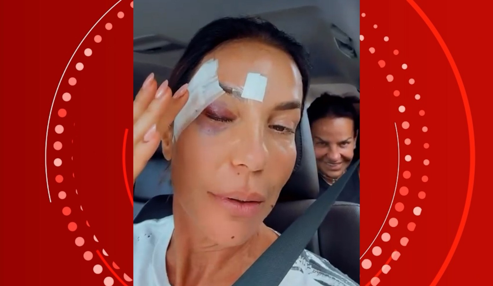 Síncope vasovagal: entenda a condição que levou Ivete Sangalo a desmaiar e se machucar | G1