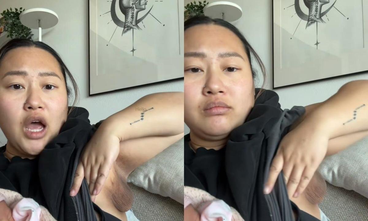 Após dar à luz, mulher desenvolve terceiro seio em lugar inesperado