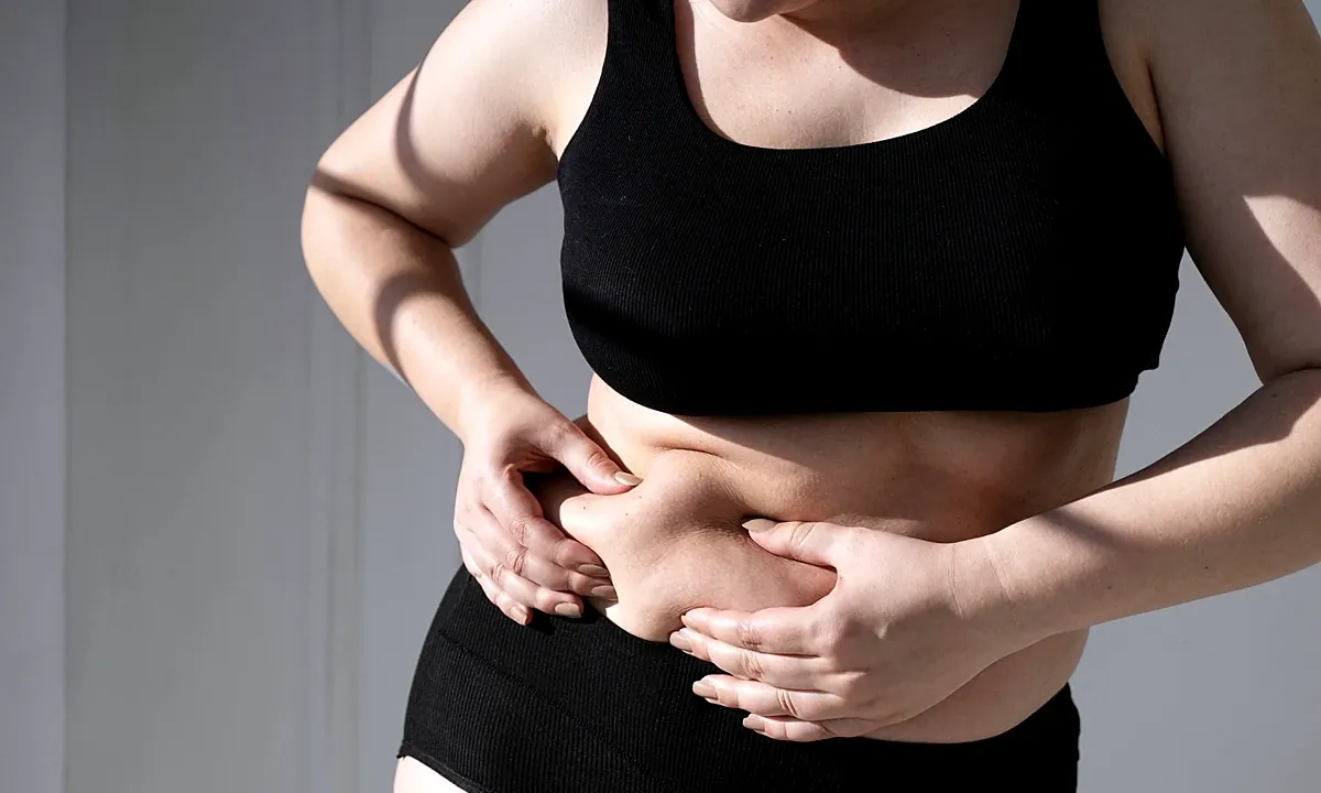 "Pochete" persistente pode ser sintoma dessas 5 doenças, diz endócrino