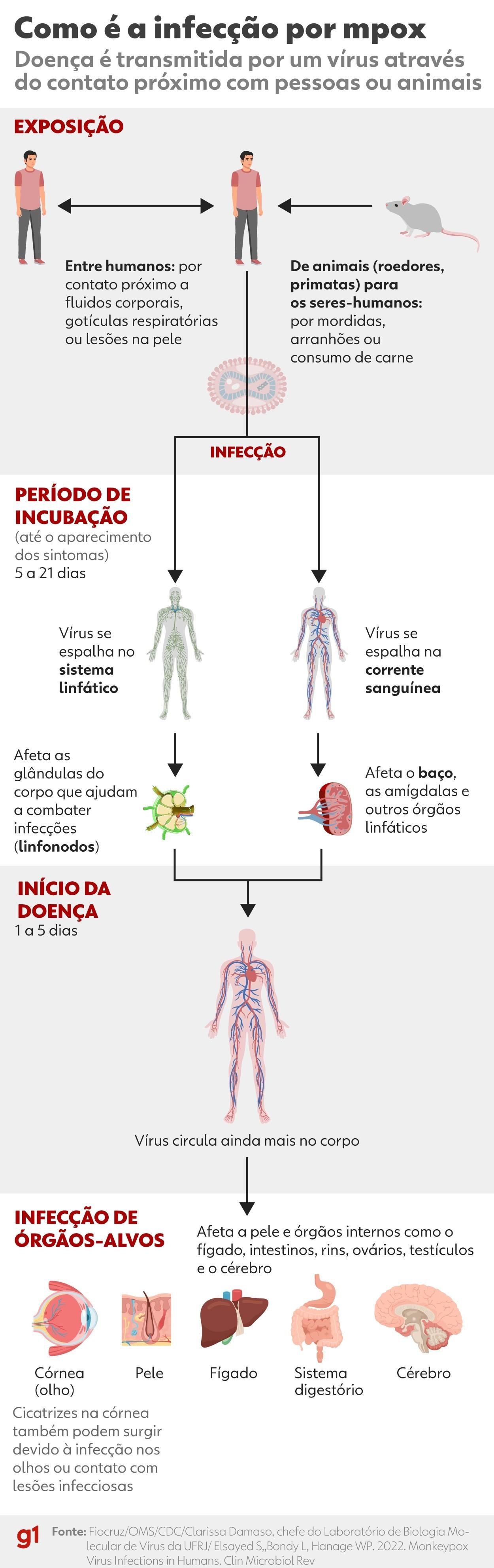 Mpox: saiba quais cidades da regiãode Campinas têm casos confirmados | G1