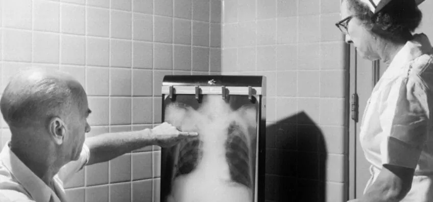 IA e novas estratégias aceleram o combate à tuberculose