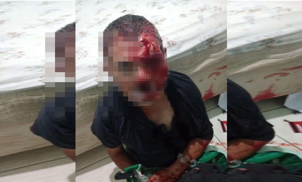 Homem que teve o rosto desfigurado por mascarada recebe alta