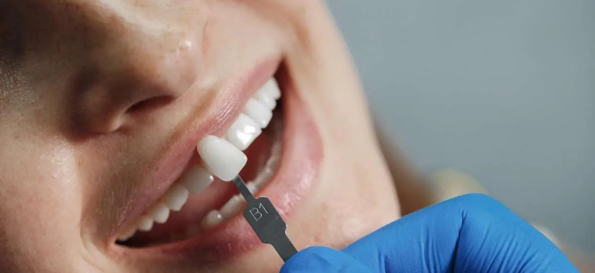 Falha em tratamento dentário nem sempre indica erro