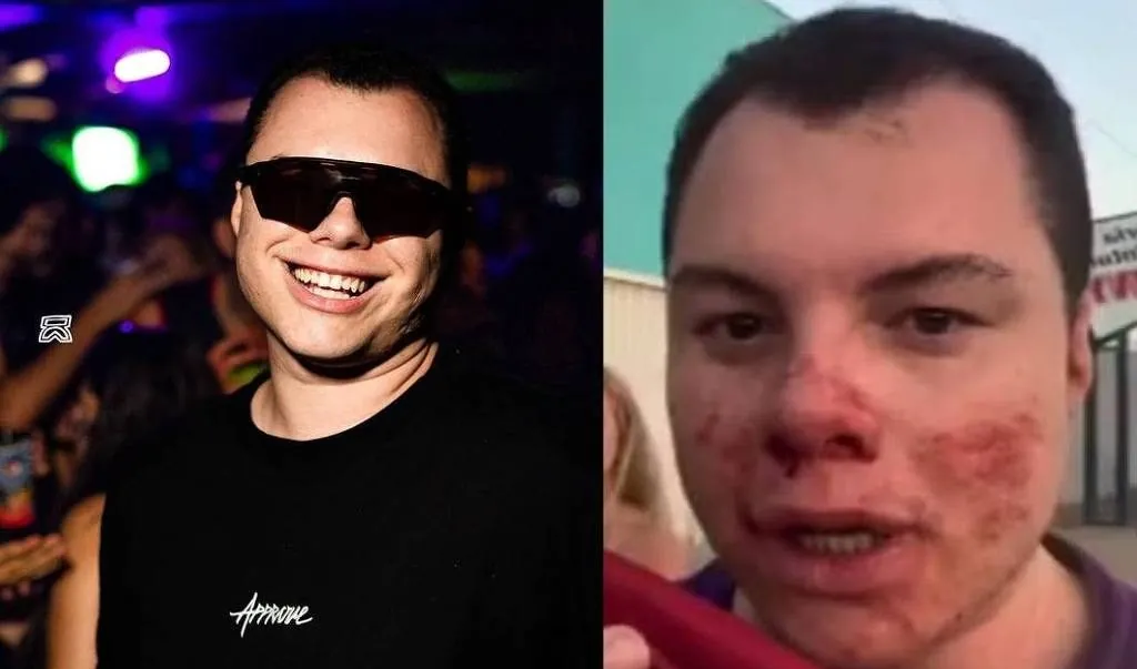 Influenciador que entrou em coma após agressão no interior de SP acorda, mas segue em estado grave