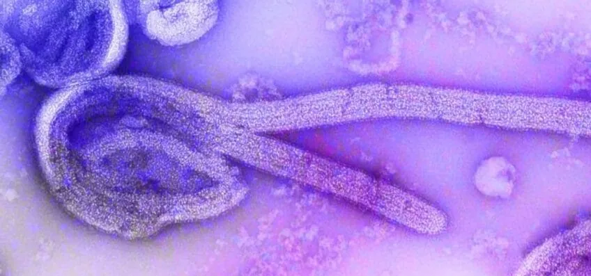 São Paulo investiga caso de ebola em homem de 37 anos