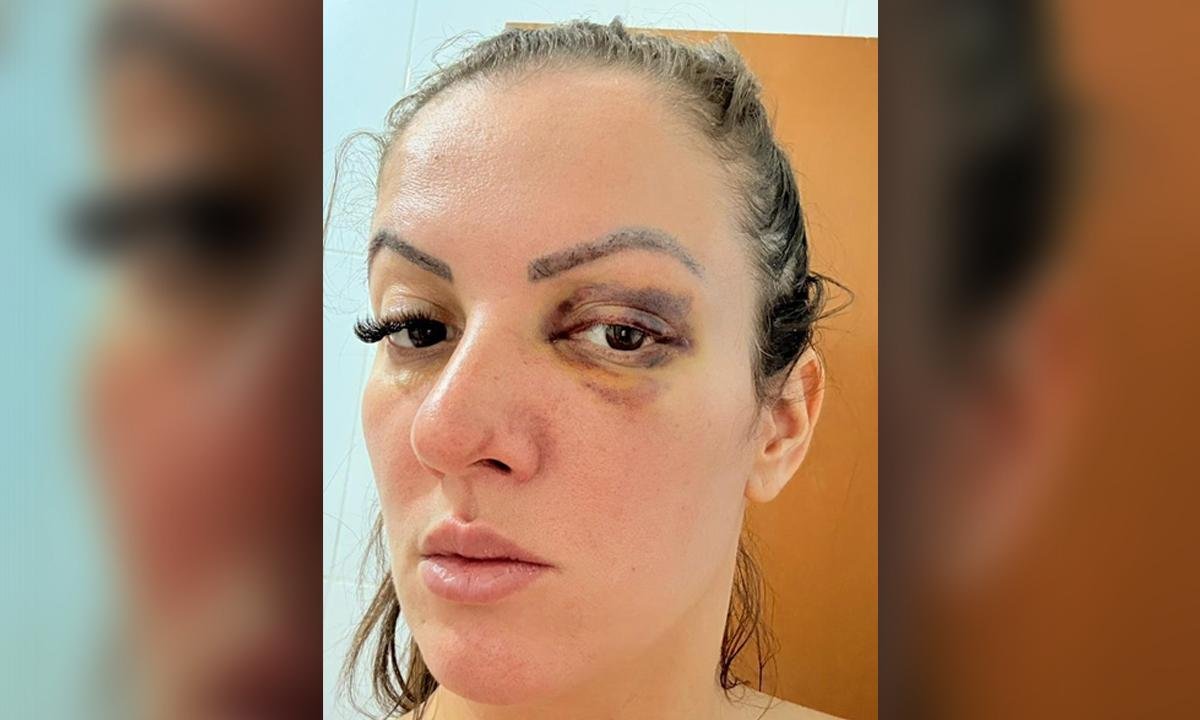 Vereadora que atropelou namorado em SP após agressão se manifesta