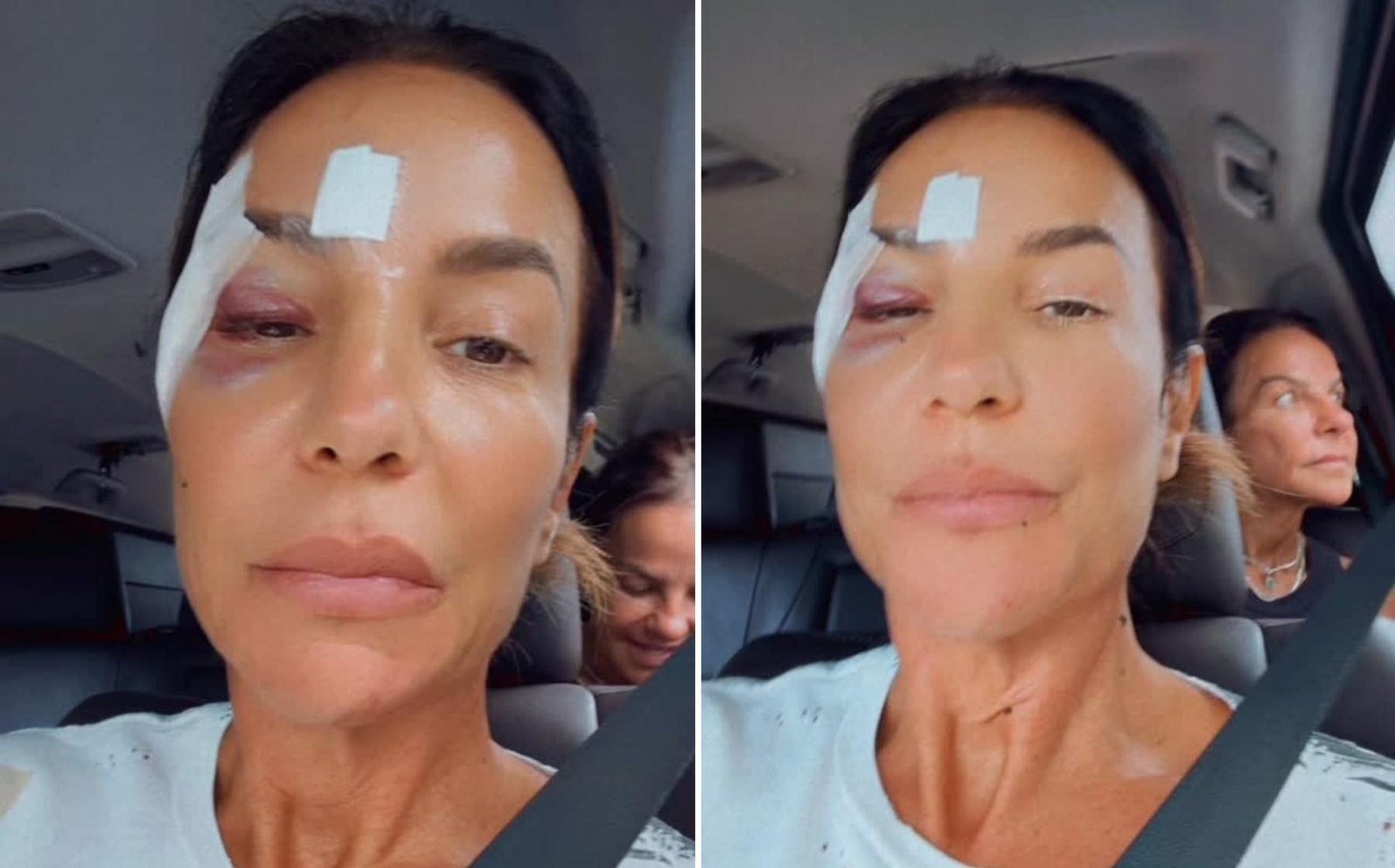 Ivete Sangalo deixa hospital após diagnóstico; saiba o que aconteceu