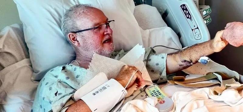 Ataque de tubarão: o relato do sobrevivente mordido em Tobago | G1