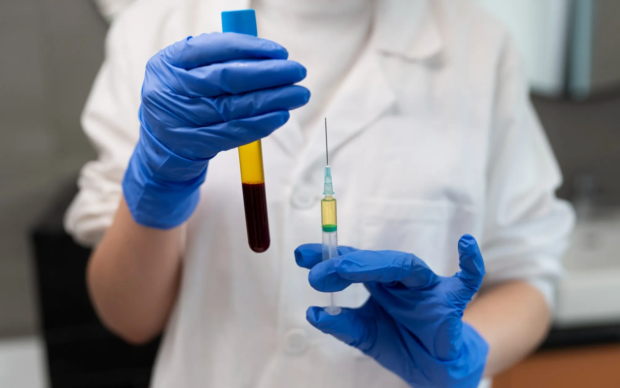 Canadá investiga duas mortes após doações de plasma sanguíneo em clínicas privadas